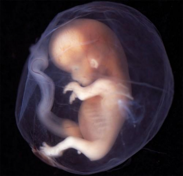 Test REVOLUTIONAR care depisteaza anomaliile genetice din primele luni de sarcină